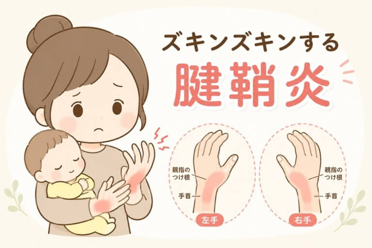 赤ちゃんを抱っこしながら手首の痛みをかばうお母さんのイラスト