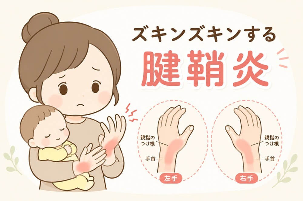 赤ちゃんを抱っこしながら手首の痛みをかばうお母さんのイラスト